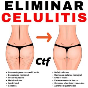 Eliminar celulitis