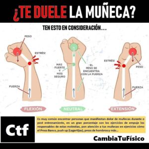 ¿Te duele la muñeca?