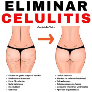 Eliminar celulitis
